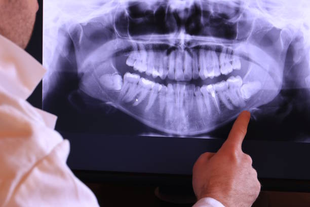 Best Emergency Dentist for Special Needs Patients in Olcott, NY
