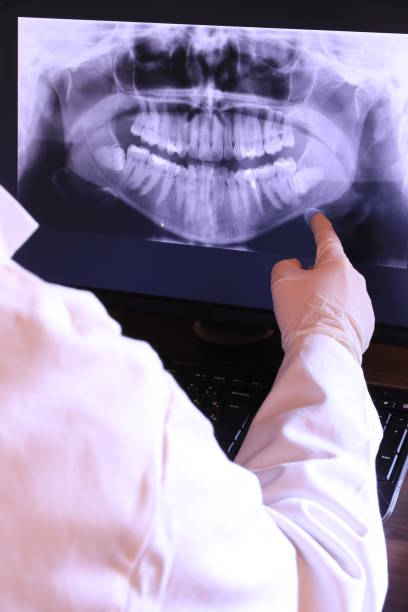 Best Urgent Dental Care for Toothache in Olcott, NY